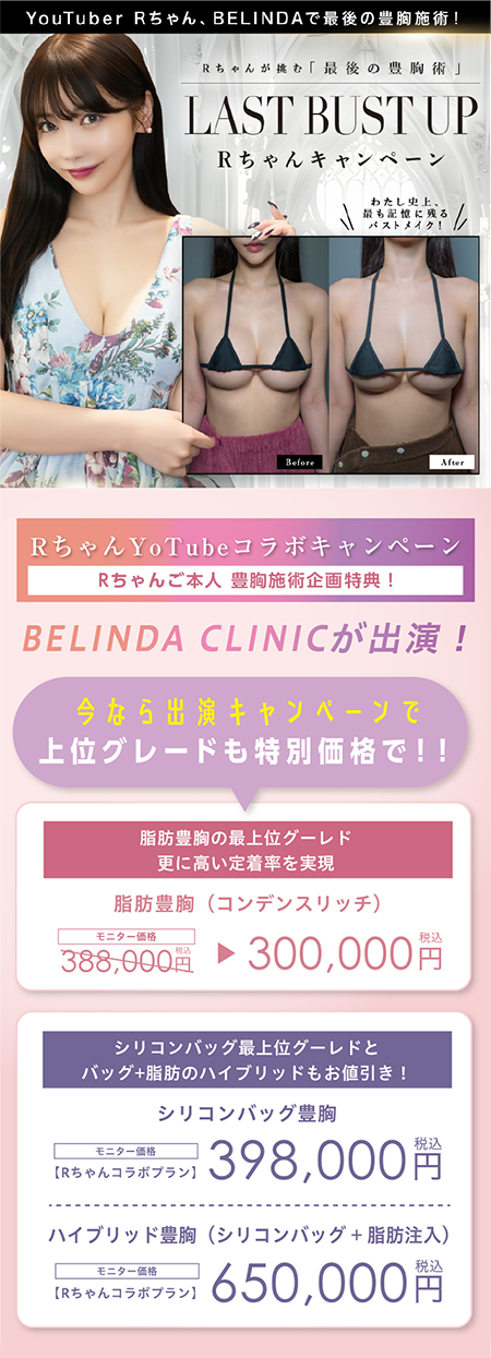 Rちゃん企画出演キャンペーン