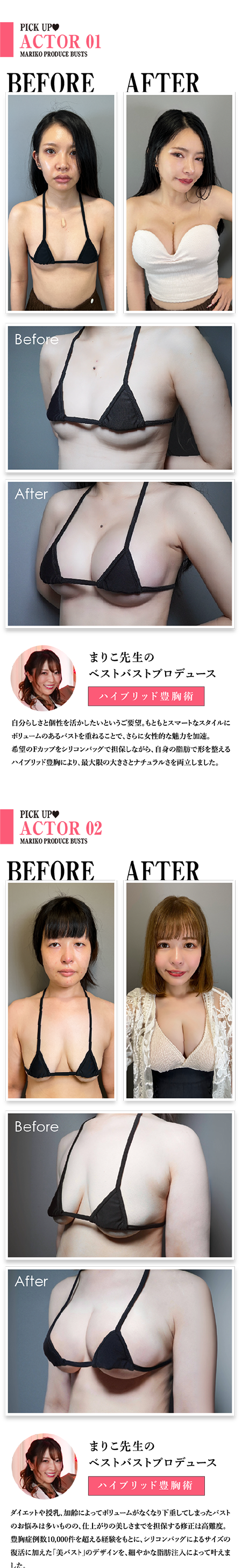 Rちゃん企画出演キャンペーン-症例
