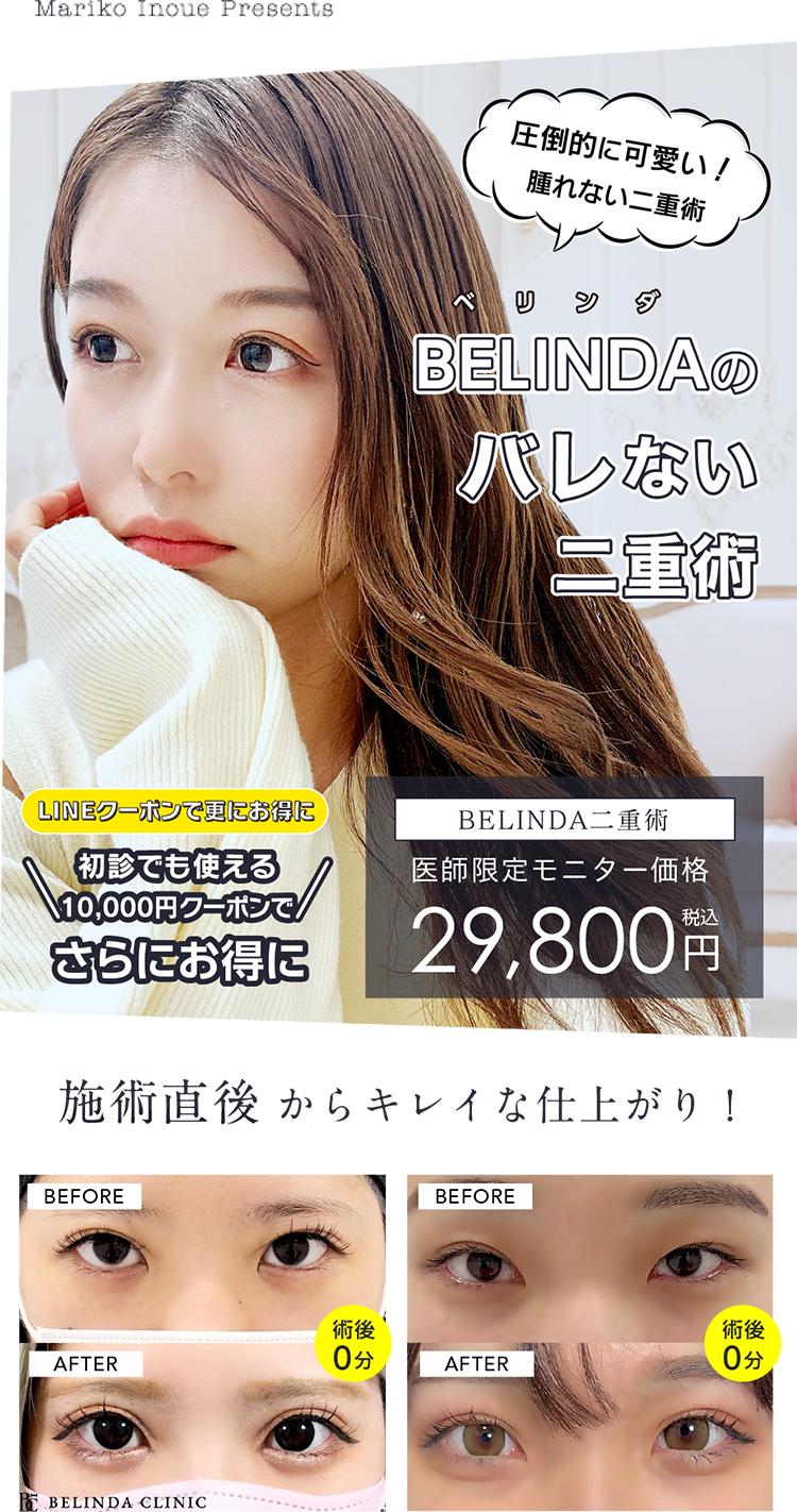 まりこ先生のバレない二重術